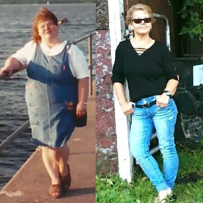 Tammy Before and After Weight Management 